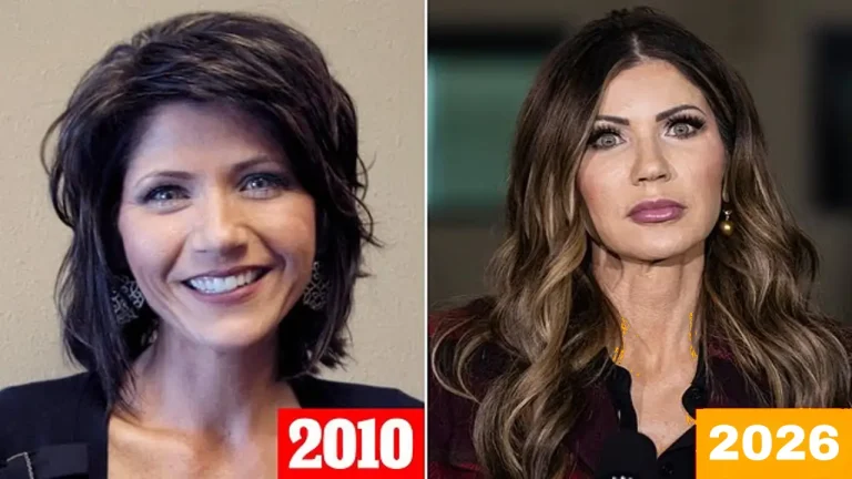 Kristi Noem Before and After Cosmetic Surgery A Tale of Transformation and Resilience