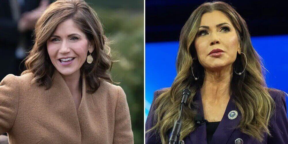 Kristi Noem Before and After Cosmetic Surgery A Tale of Transformation and Resilience