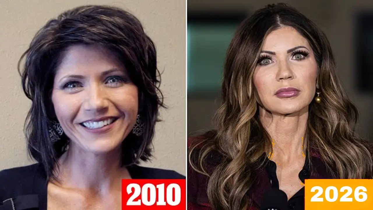 Kristi Noem Before and After Cosmetic Surgery A Tale of Transformation and Resilience